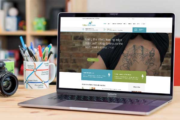 Tattoo Removal Auckland